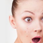 8-Homemade-Face-Packs-For-Oily-Acne-Prone-Skin-With-Videos